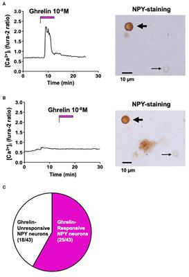 Ninjin'yoeito Targets Distinct Ca2+ Channels to Activate Ghrelin-Responsive vs. Unresponsive NPY Neurons in the Arcuate Nucleus